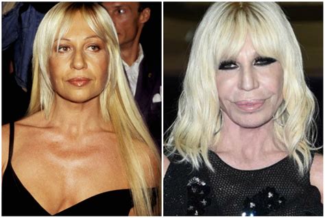 la trasformazione di donatella versace|donatella versace husband.